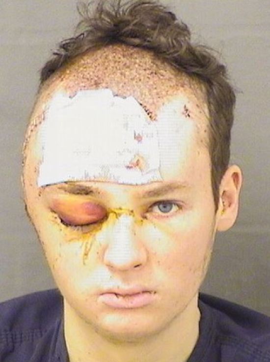 Larkspur Trail Nightmare: Lawsuit Dismissed, Pbso Response Questions Remain - Boca Post Larkspur Trail Nightmare: Lawsuit Dismissed, Pbso Response Questions Remain - Boca Post