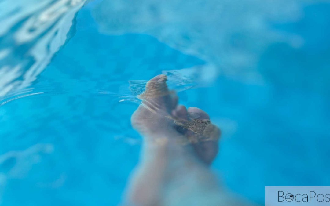 Man Says He Stepped On Sharp Object In Pool At The Boca Raton, Lawsuit Says