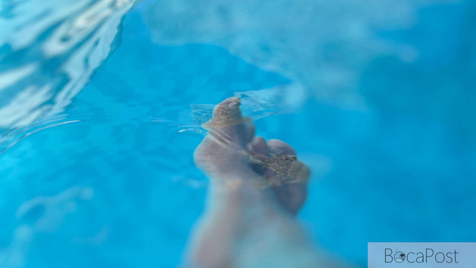 Man Says He Stepped On Sharp Object In Pool At The Boca Raton, Lawsuit Says