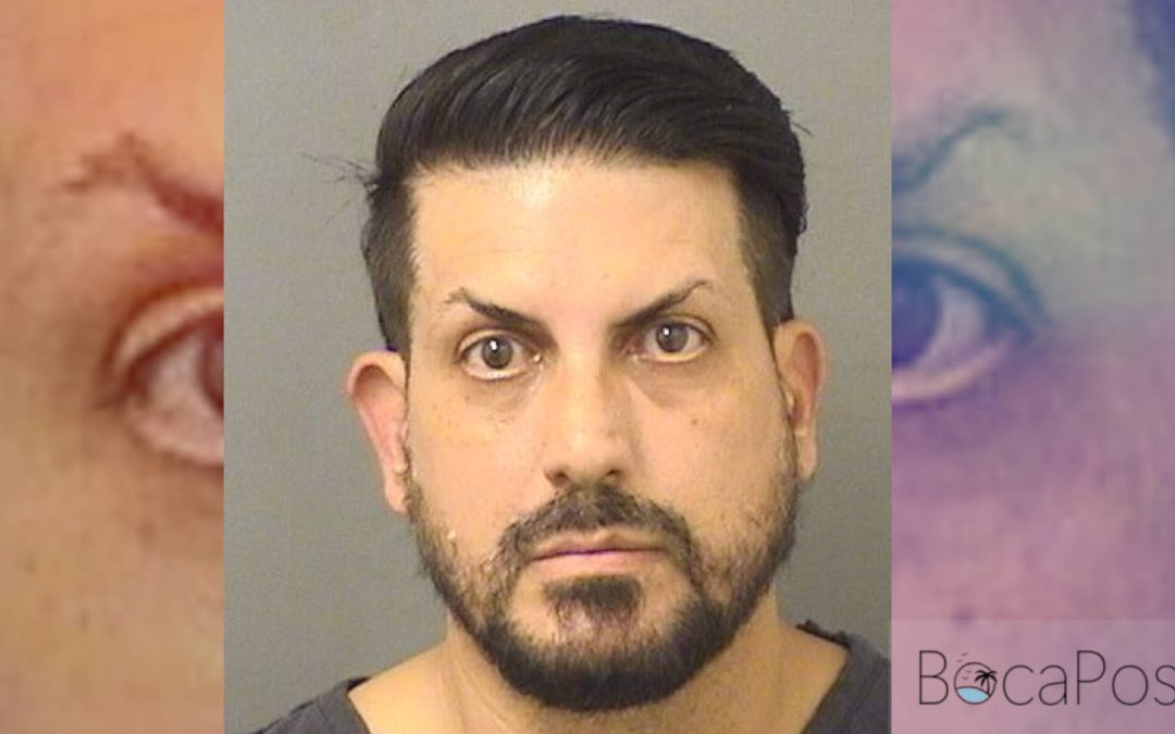Boca Raton Stress Technician Accused Of Stealing Patient’s Credit Card